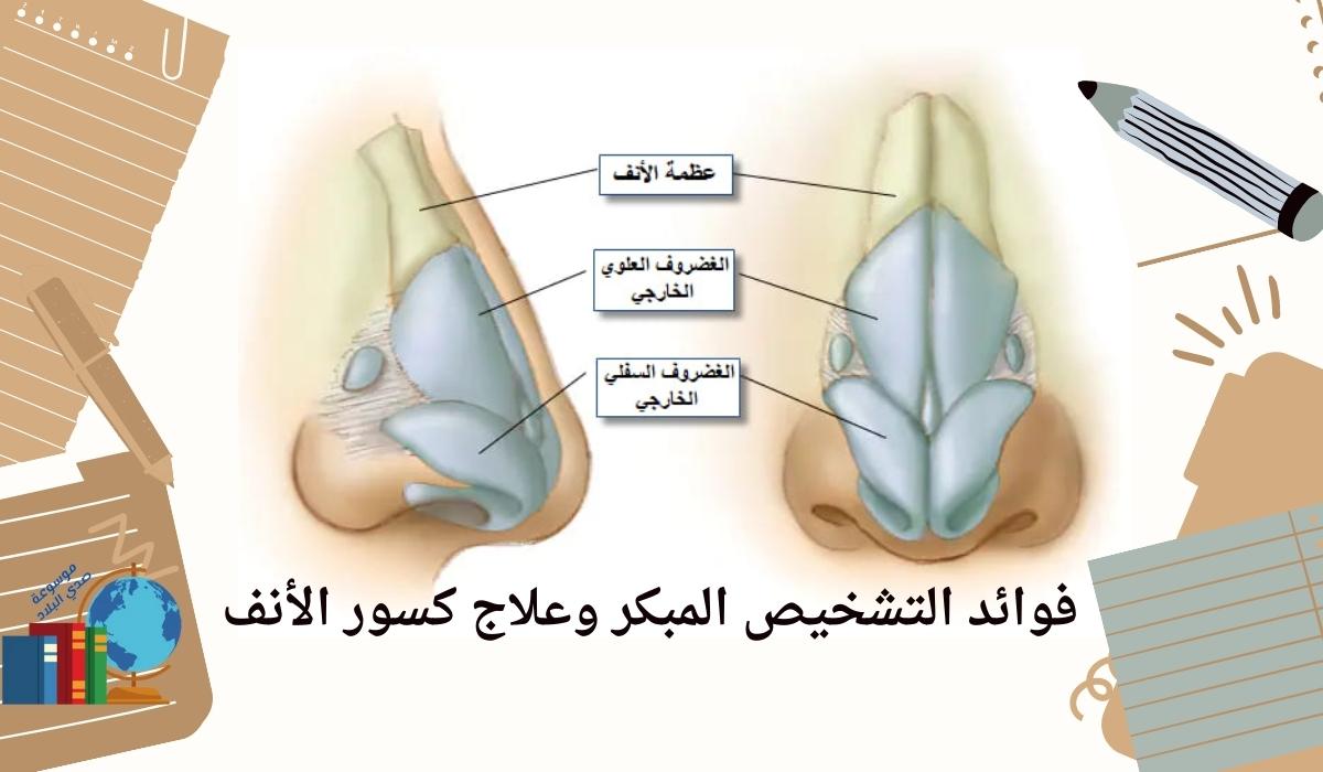 فوائد التشخيص المبكر وعلاج كسور الأنف