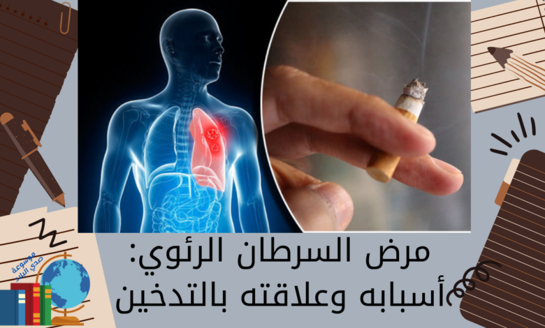مرض السرطان الرئوي أسبابه وعلاقته بالتدخين