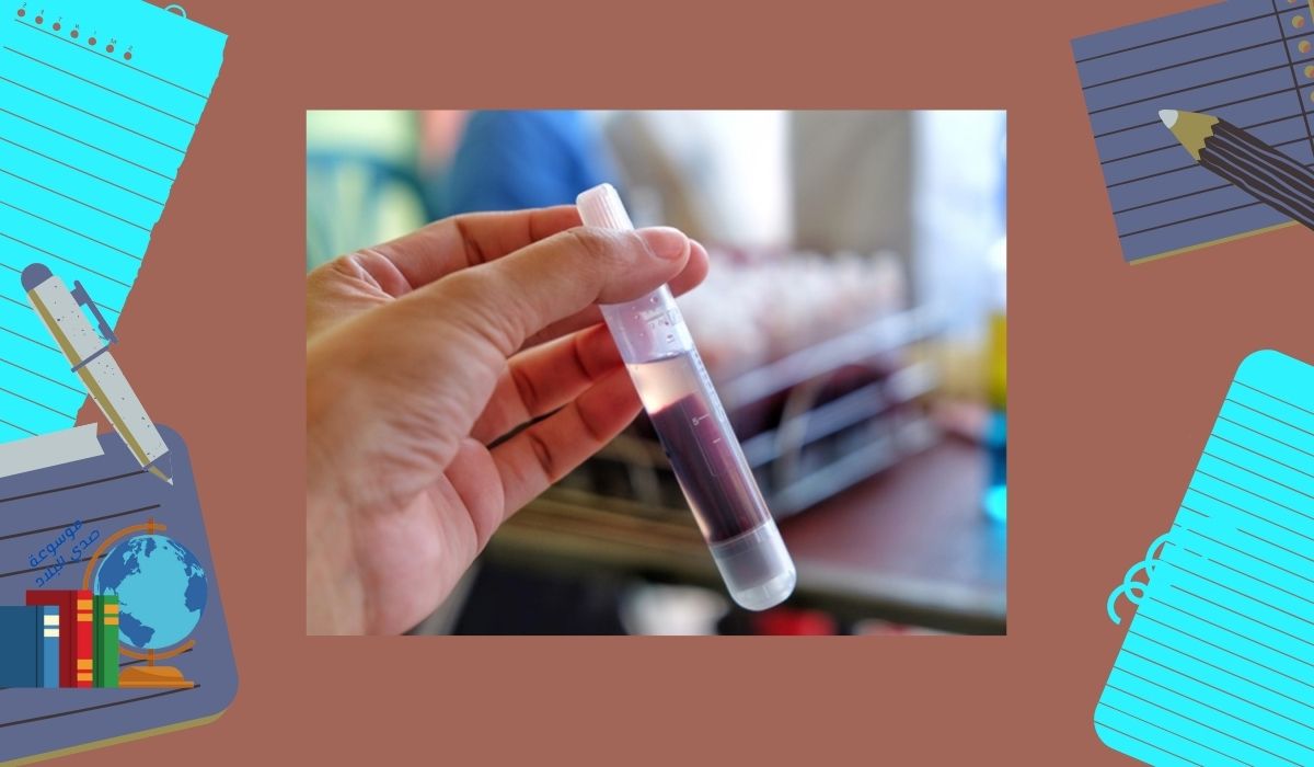 هل الحمى المالطية تسبب الوفاة