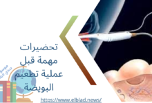 تحضيرات مهمة قبل عملية تطعيم البويضة