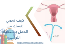 كيف تحمي نفسك من الحمل باستخدام اللولب