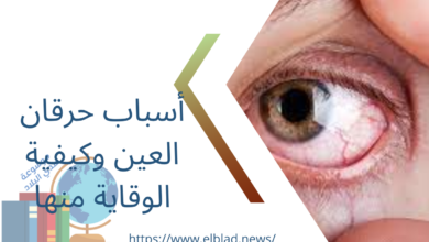 أسباب وعلاجات حساسية العين