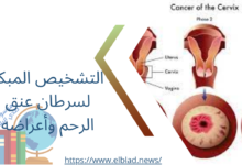 التشخيص المبكر لسرطان عنق الرحم وأعراضه