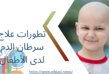 تطورات علاج سرطان الدم لدى الأطفال